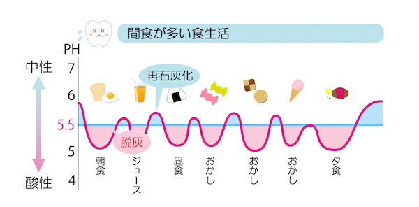 ステファンカーブのイメージ画像｜夏こそ要注意！水分補給のつもりが虫歯リスクUP！？｜愛媛県松山市の歯医者「もりもと歯科クリニック」
