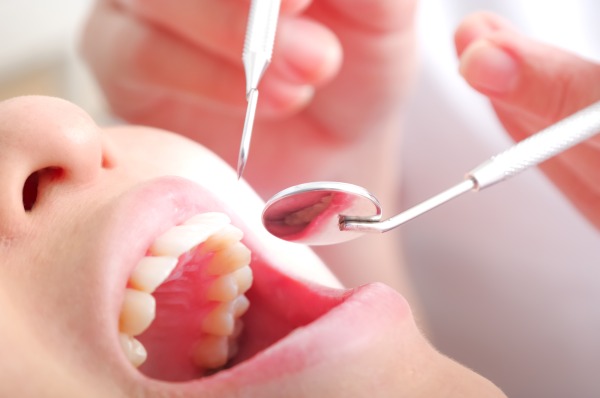 歯の治療を行っている様子｜2026年6月 診療報酬改定｜CAD/CAM冠・インレーの適応範囲が大きく広がります｜金属アレルギー・掌蹠膿疱症専門歯科医療サイト｜愛媛県松山市もりもと歯科クリニック